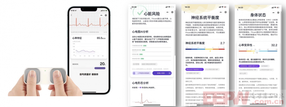 基于自研心电芯片国产化手持单导/6导/12导心电仪解决方案